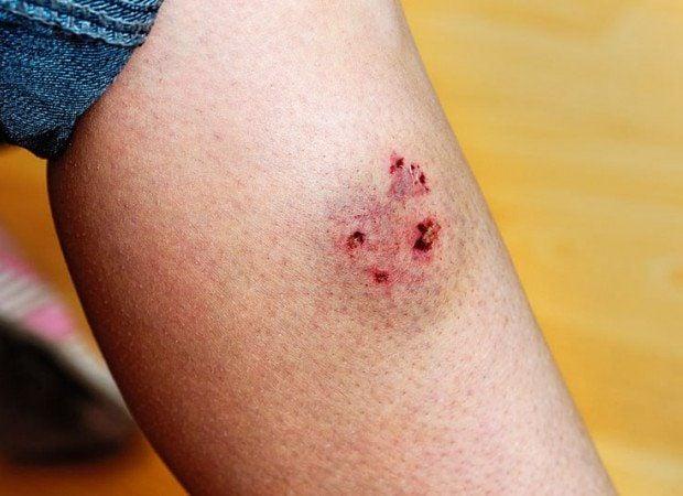 Giải Mã Giấc Mơ Thấy Mẹ Bị Bệnh và Con Số May Mắn