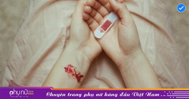 Giải mã giấc mơ đứt ngón tay