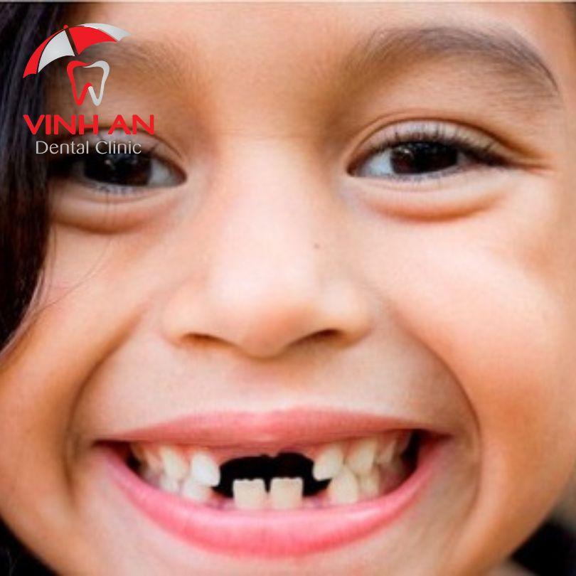 Giải Mã Giấc Mơ Bắt Được Nhiều Cá Trê