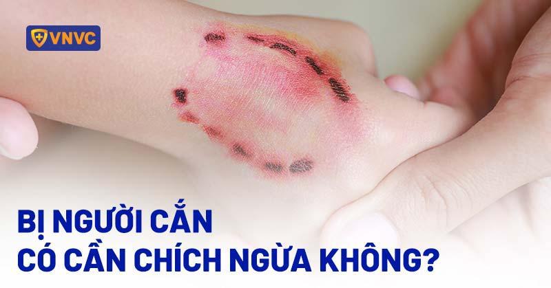 Hổ cắn người khác