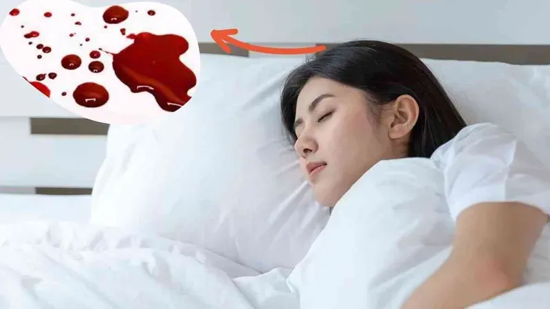 Nằm Mơ Thấy Cá Chết Nhiều Đánh Con Gì?