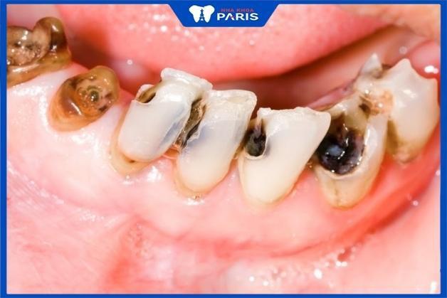 Nằm Mơ Thấy Con Mình Chết: Giải Mã Số Đề và Ý Nghĩa