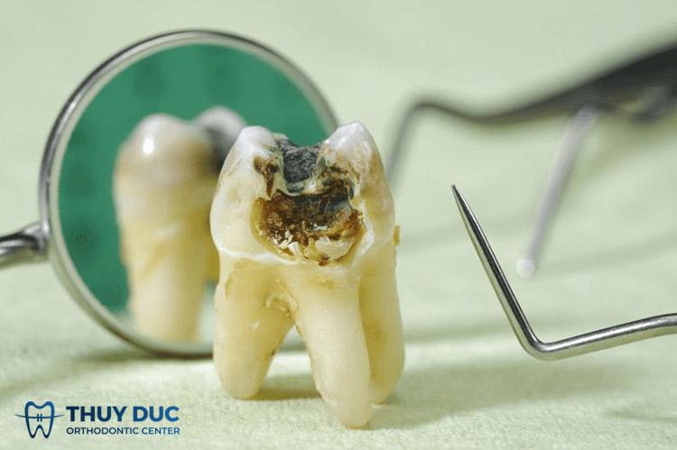 Giải Mã Giấc Mơ Đêm Nằm Mơ Phố Thùy Chi