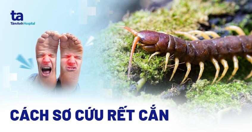Rết cắn chân số đề liên quan