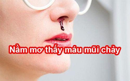 Sổ mơ lô đề giải mã giấc mơ chảy máu mũi